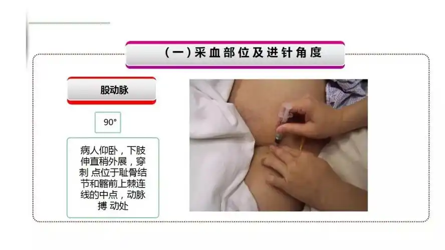 ppt动脉血气分析采集方法及注意事项