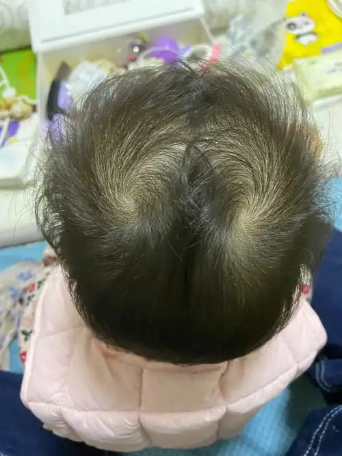 头顶两个旋脾气超大