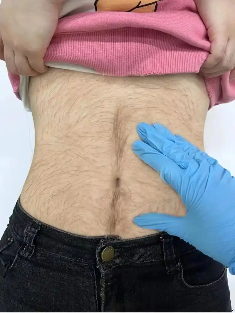 那种天生汗毛就比较重的女孩子 - 抖音