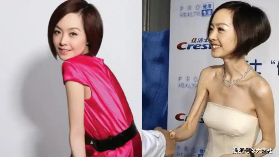 瘦未必漂亮盘点10位暴瘦女艺人对比照确定有点恐怖了