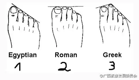 人类脚趾依据长度可分为埃及脚,罗马脚,希腊脚3种,其中第2根脚趾比
