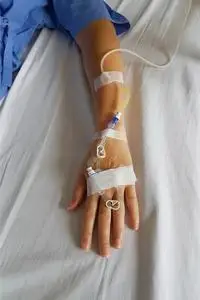 滴针病人手上有滴管输液针进行静脉输液.照片