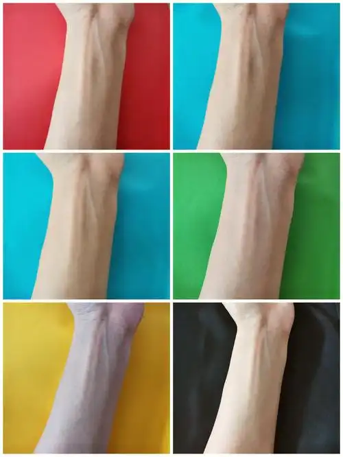 我的血管什么颜色都有,我实在不明白自己肤色了,我是中性色吗