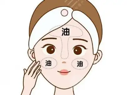 油性皮肤