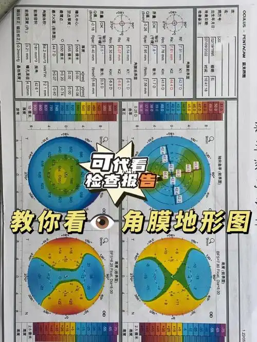 值得收藏的干货|93角膜地形图怎么看?