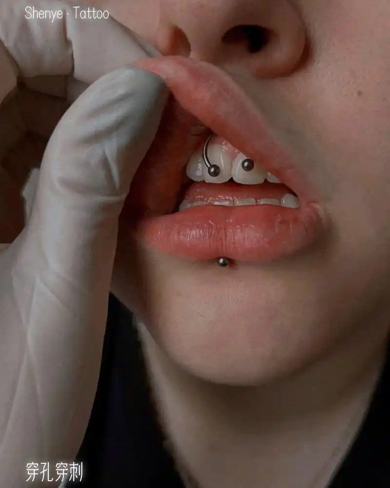 穿孔·德古拉钉(微笑钉)唇细带钉有很多名称 最为大家熟知的叫 - 抖音