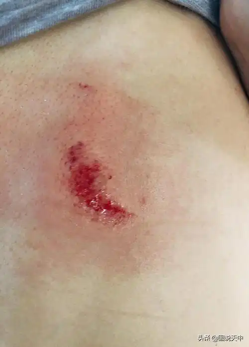 张馨予妈妈为什么受伤?张馨予妈妈照片个人资料