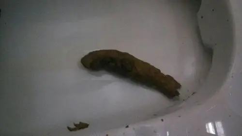 请问这个属于黑便么?哎呀,总是感到疼痛才