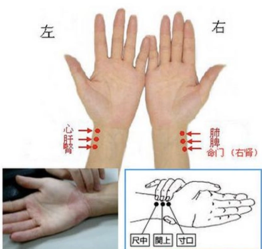 喜脉是怎么摸出来的其实方法很简单看完自己也能摸出来