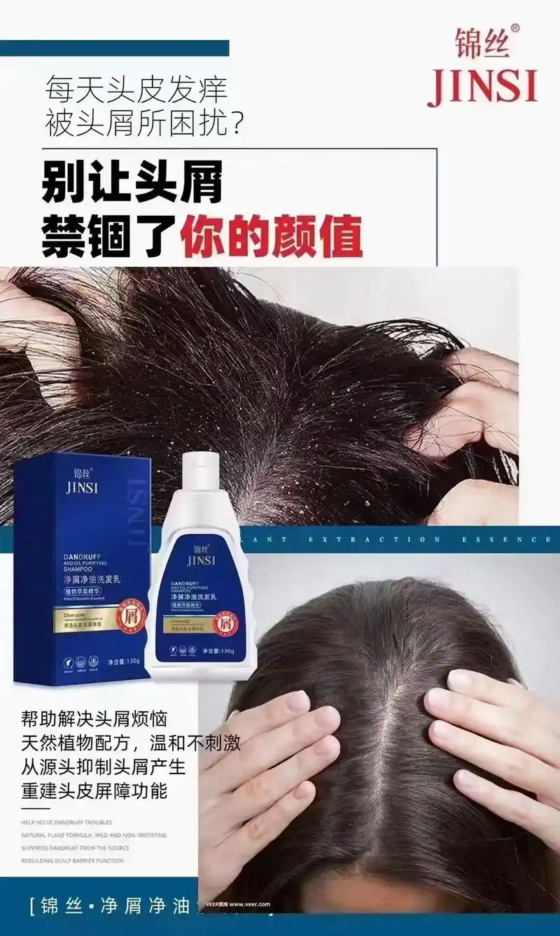 治头皮炎症.锦丝洗发水: 90 头皮屑大片大片,头油,头痒! - 抖音