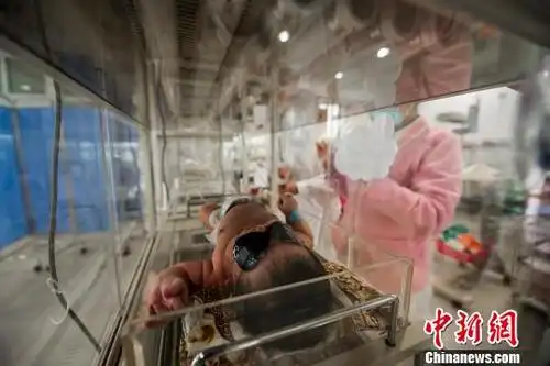 趣闻轶事"我是剖腹产,当时医生拿不出来,只好三个人一起帮忙拉",回忆