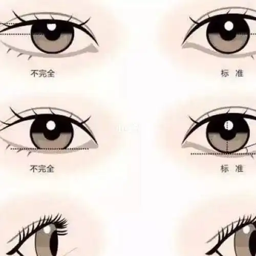 眼球外突特别严重的原因一个是天生,一种是近视度数太深的.