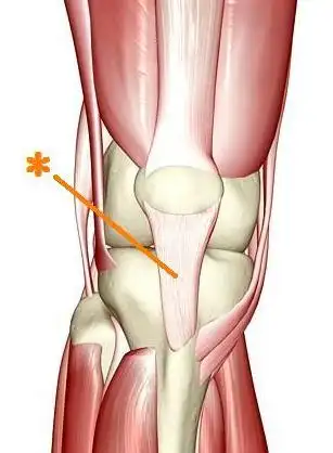 【运动康复科普】髌韧带损伤的机制与康复训练方法