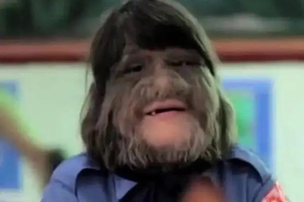 世界上体毛最多的女人浑身长满毛发剃完毛后惊艳众人