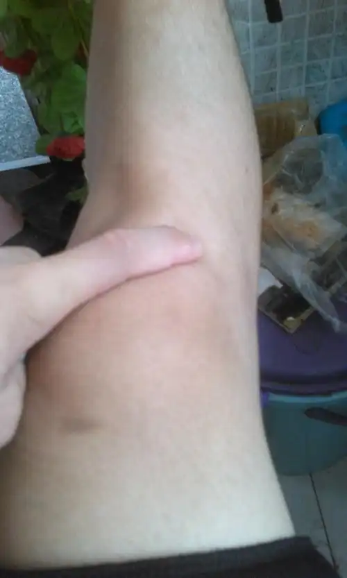 不过不痛我也就没多想.