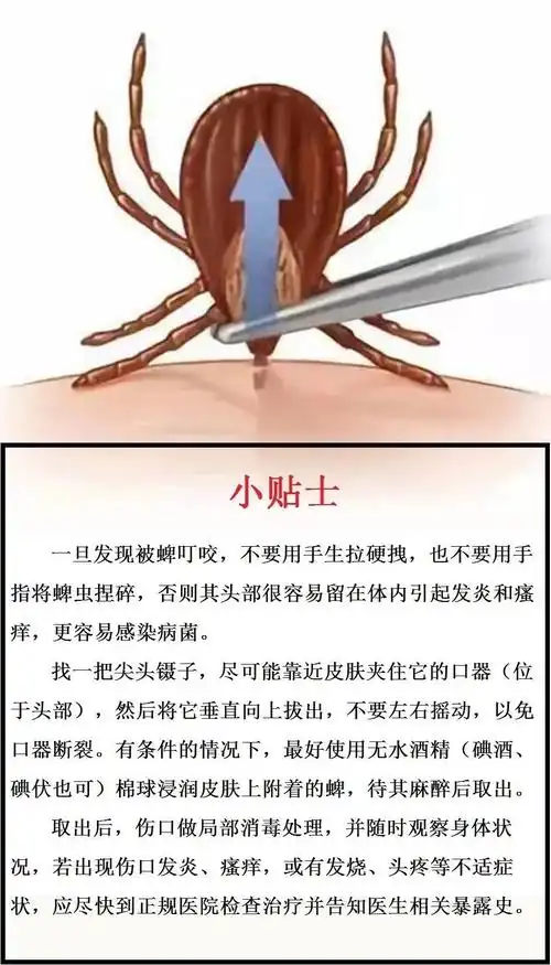 【健康科普】"蜱虫病"不可怕!