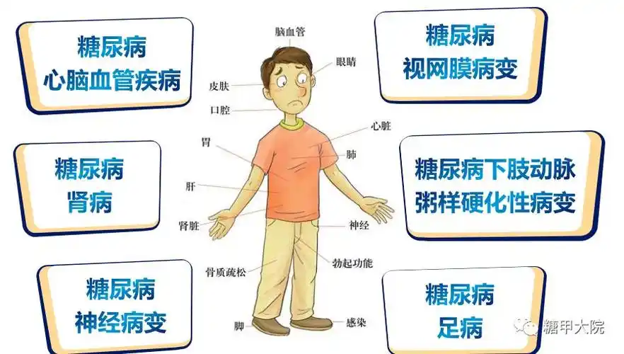 糖甲科普李医生得了糖尿病并发症还有救吗
