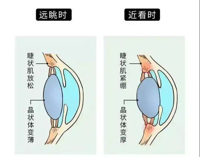 按摩可以提高视力治疗近视吗