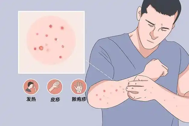 不必恐慌,赶紧来认识一下|症状|疫区|传染源|新冠病毒_网易订阅