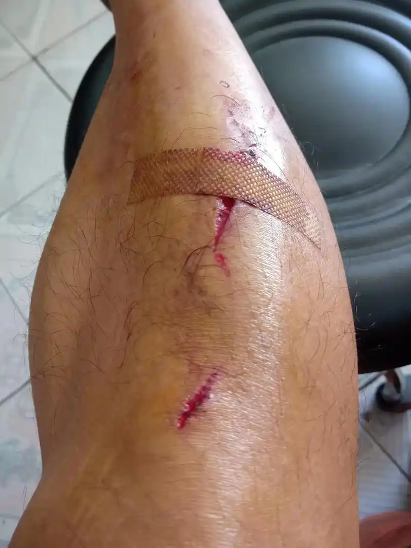 由于昨天上午腿受伤了,一周内不能晨跑打卡啵!军人__骨子里的 - 抖音