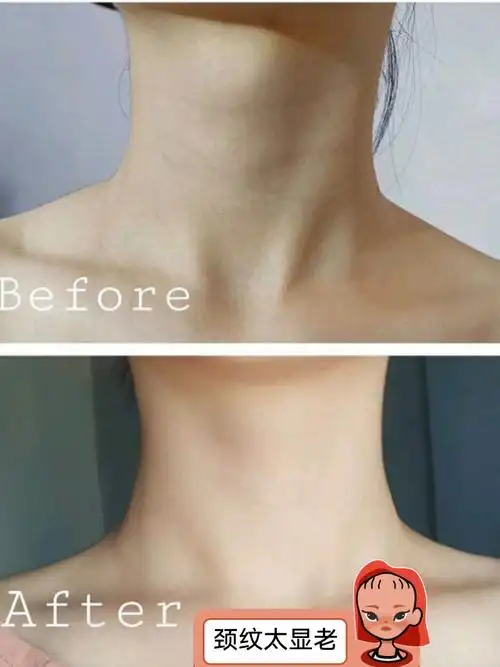 不保养看脖子,颈部细纹一不小心就会暴露你的肌肤年龄!