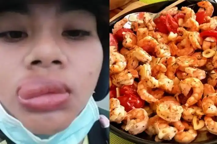 吃虾过敏怎么办