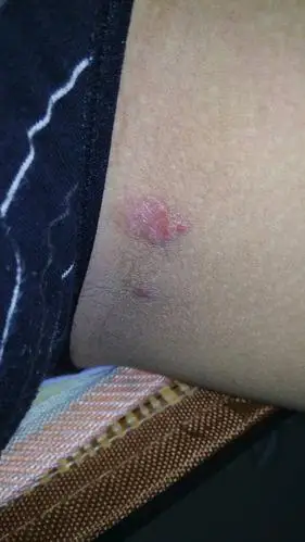 是裤子磨出来的?