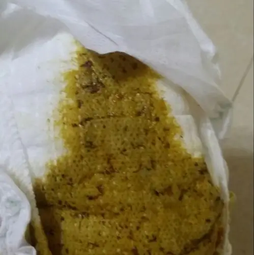 急急急!宝宝便便里有黑色线状东西,好像线虫啊,很多,好恐怖,求助啊