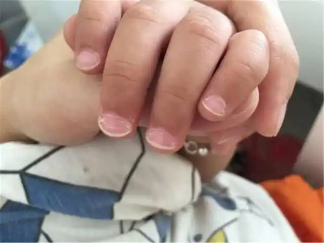 育儿医生直言:孩子从小咬指甲,以后逃不出这俩结果,父母别大意