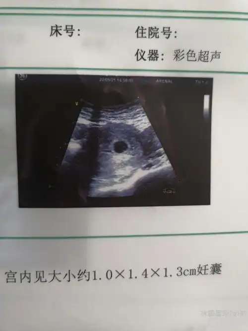 孕囊大小看男女的方法 1孕囊大小看胎儿性别 有传言说,如果孕囊大小的