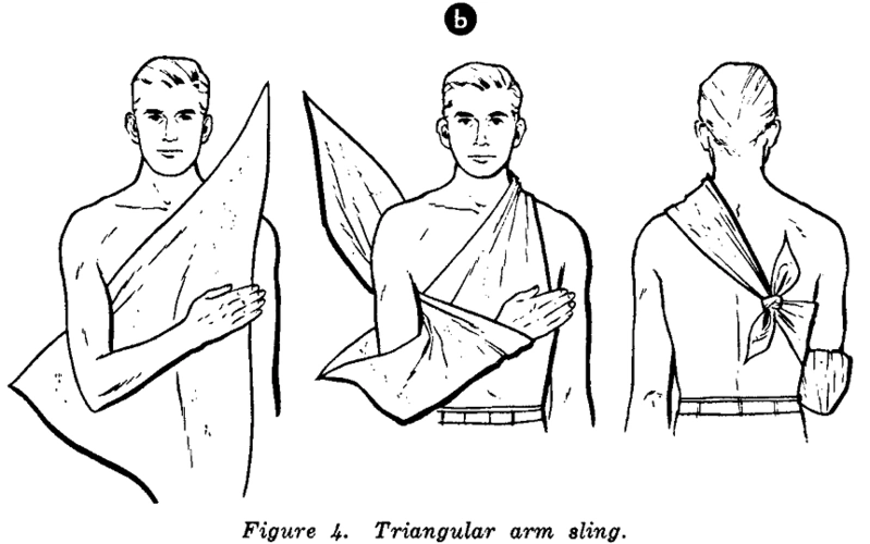 三角巾各种绑法图片(免费)