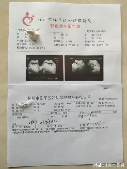 开怀孕6周褐色血图片长沙血清怀孕检查报告单郑州怀孕流黑色血图片开