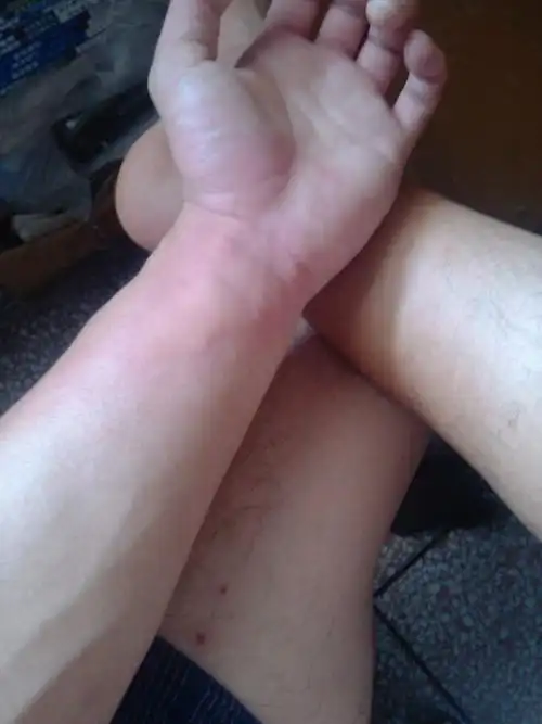 请问,我的皮肤怎么了.