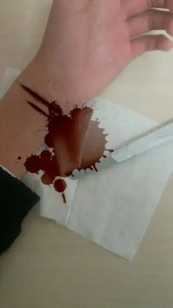 能不能帮我p一张割手腕的图片,血不要太夸张,下面是我手腕的照片