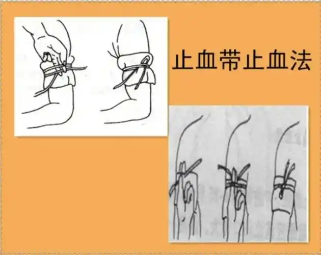 意外伤害丨止血,包扎,固定,这些技能关键时候能救命!