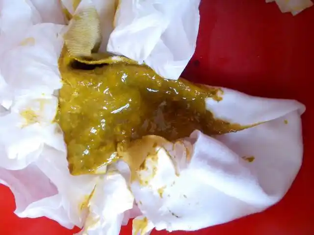 两个月宝宝拉这种大便正常吗?有酸味但无臭味.