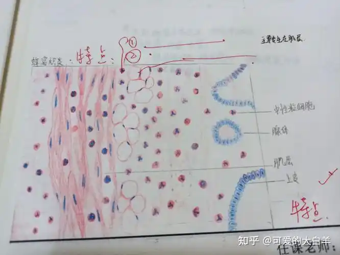 肉芽组织(多画一些毛细血管,成纤维细胞记得画出特点,我画的成纤维