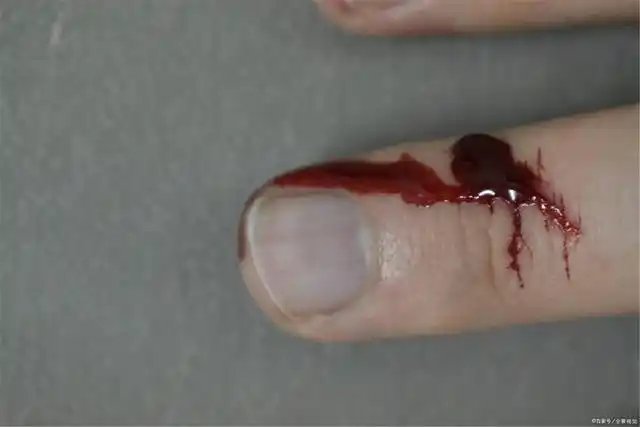 温玉的手化脓流血了,仅供参考