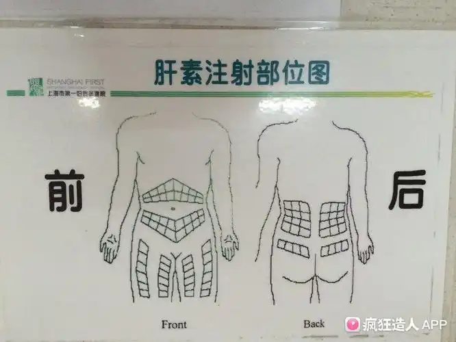 孕中期后期有打肝素的姐妹吗?