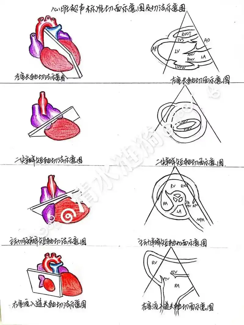 手绘心脏超声标准切面示意图及切法示意图 - 抖音