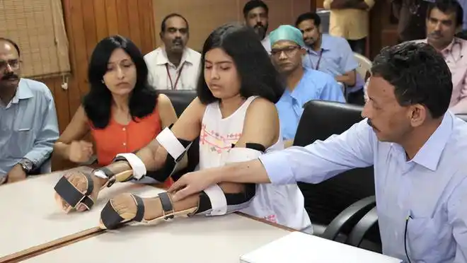 印度花季女孩因车祸双臂截肢移植黑人手臂后肤色发生改变