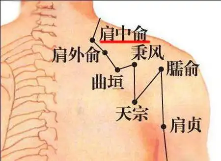 骨病患病的新希望拨针之法