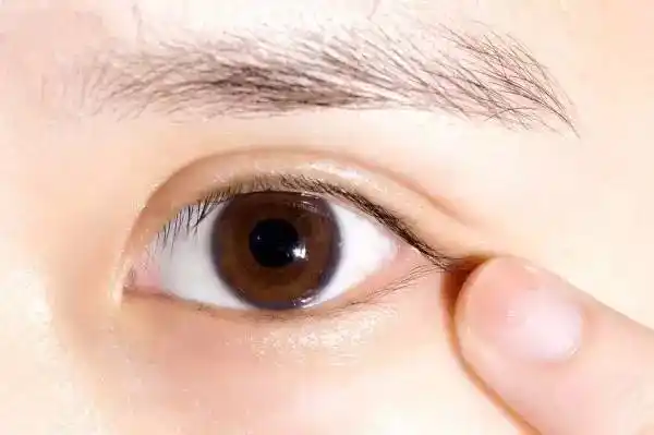 眼角痒不是小事,你可能是这些部位出了问题!