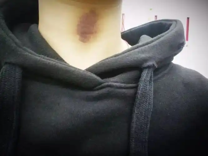 一雪入冬超越999感冒灵的滋补特效药