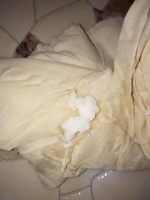 月经推迟三天了,刚刚从下面排出来的,请问下这是什么?