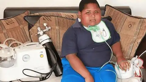 这种名为prader-willi综合症让caden 10岁体重就超过180斤.