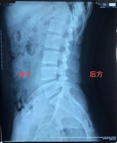 ct相关注意事项:同样焦点对准图像正中,整张片子照下来.