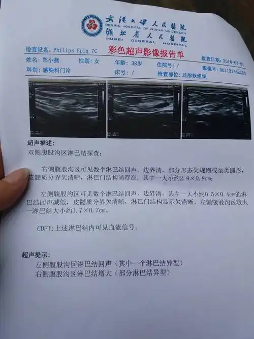 康复一年半了,腹股沟淋巴结比以前大了