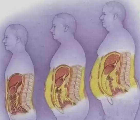 变胖带来病和傻