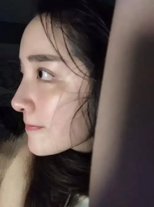 兰州隆鼻#鼻子侧面看起来很不错,毫无违和感,鼻尖表现点也很不错,是